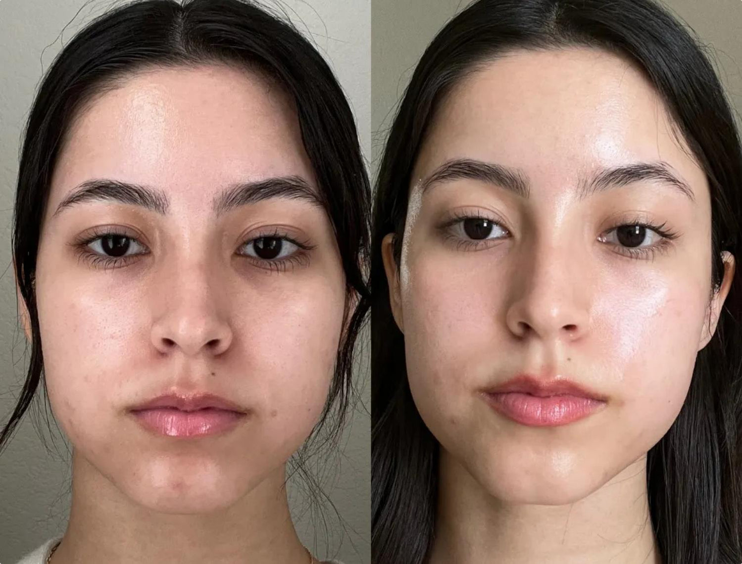 Results-driven skincare